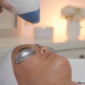 LÁSER FACIAL 30minutos