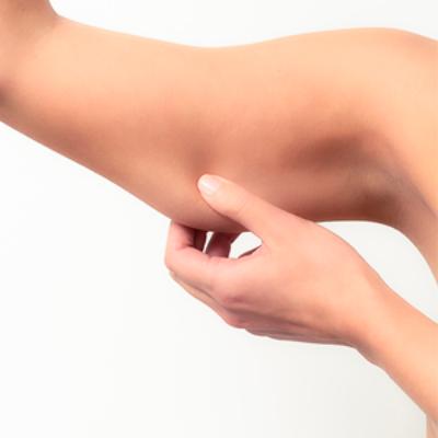 Liporadiologie Vinci: Flacidez de brazos y reducción de volumen y celulitis