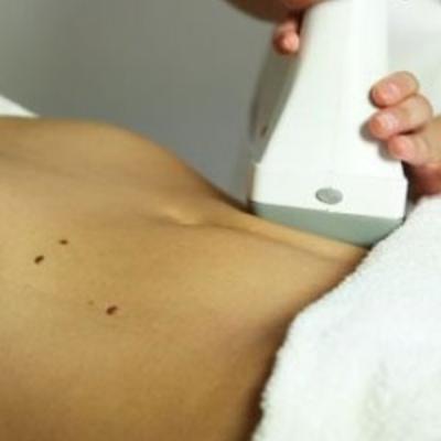 Liporadiologie Vinci: Pack Lumbares + Piernas o Abdomen