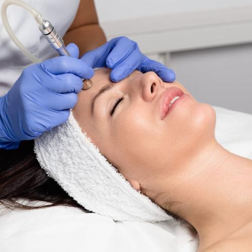 HIGIENE FACIAL CON PUNTA DE DIAMANTE