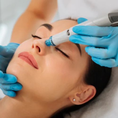 HIGIENE FACIAL CON MICRODERMOABRASIÓN
