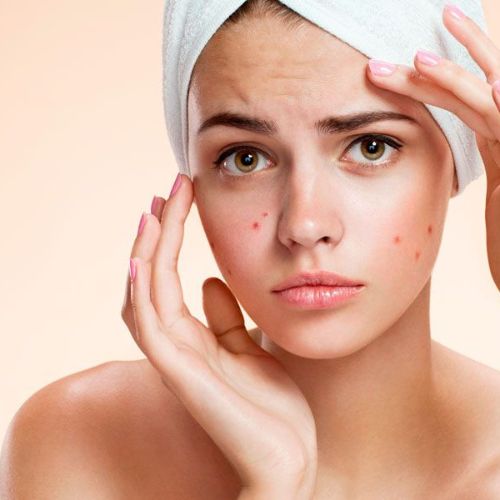 CURA FACIAL PARA ADOLESCENTES