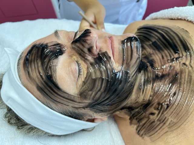 Tratamiento Carbon activo